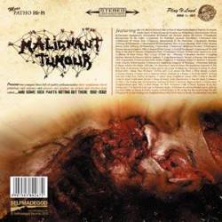 Malignant Tumour : And Some Sick Parts Rotting Out There 1992-2002